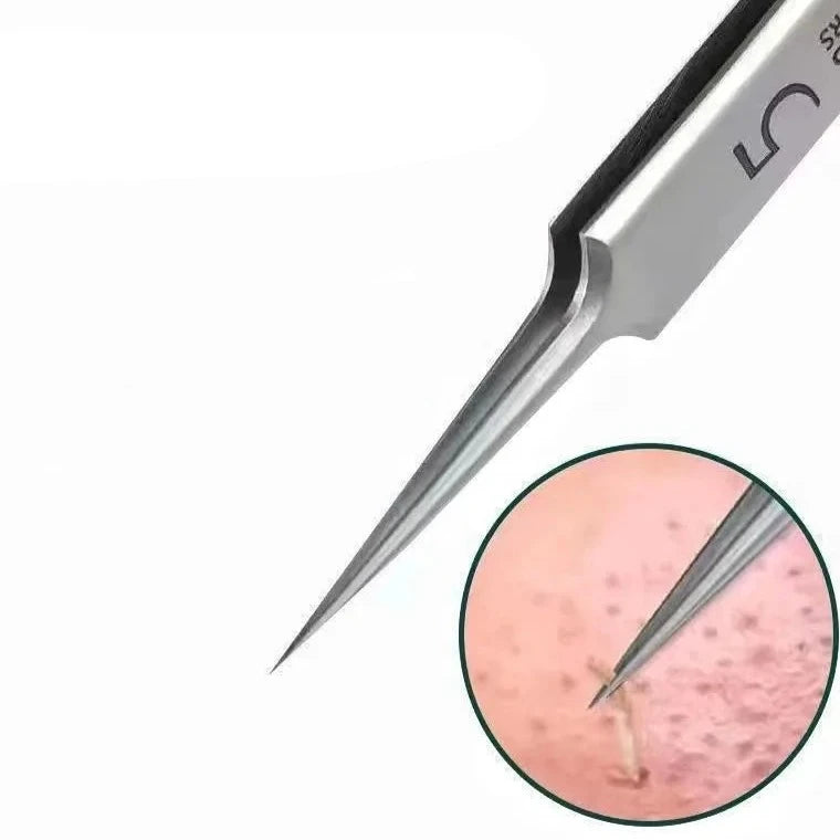 3 Pinças para Cravos e Espinhas